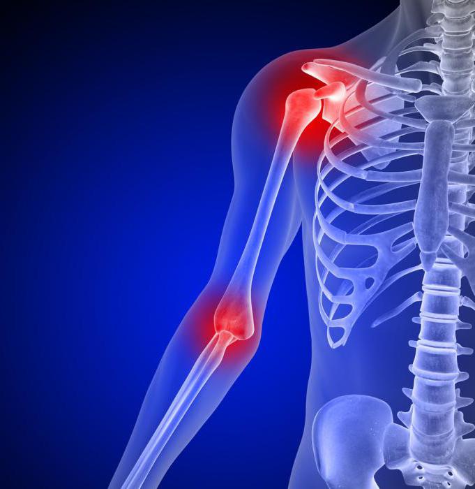 Жолда иық попка түседі