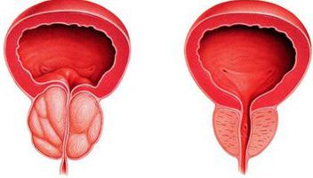 Пермьдегі жұптық секс әдемі кеуделері бар қызыл шаштар