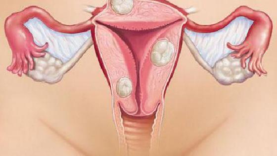 Мэри Уэр Деннетт өмірінің жыныстық жағы