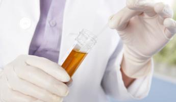 Kenapa Darah Dalam Air Kencing Seorang Lelaki Punca Dan Kemungkinan Penyakit