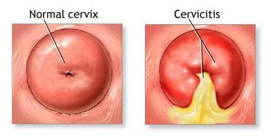 Саяжайдағы интимдік сурет Кез келген түрдегі арық әйелдердің порнофотосуреттері