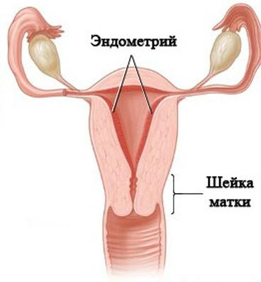 hipertenzija endometrij