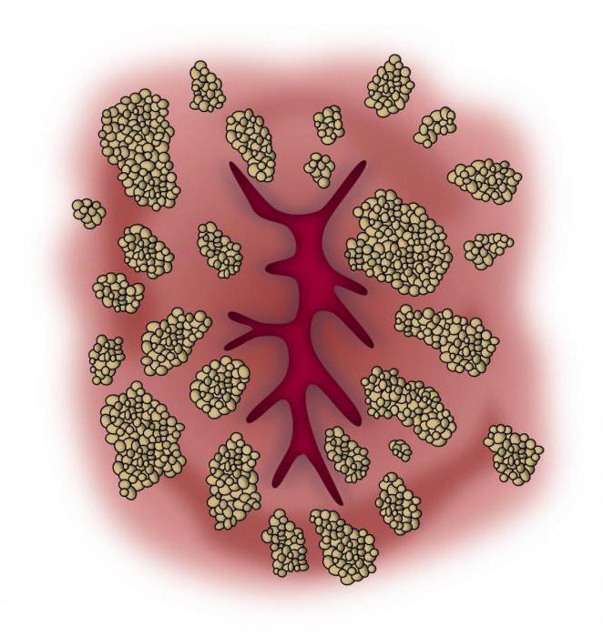 Орыс жасырын камера бірінші анал