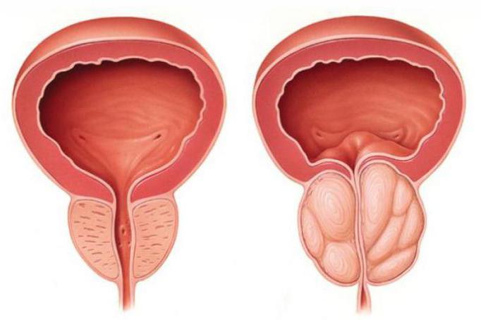 Мастурбация кезінде ақ разряд