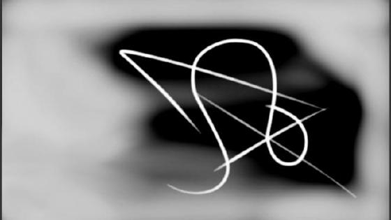 Медициналық тексерудегі жалаңаш суреттер