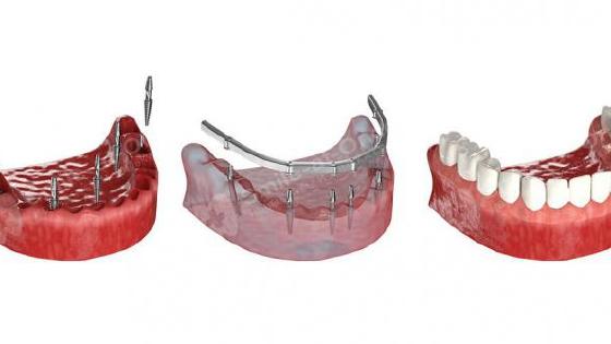 Vera Brejneva haqida Blowjob