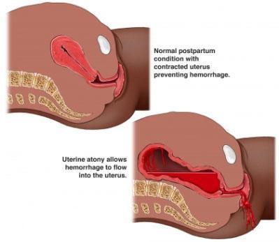 Көпшілікпен сұр порно Жыныстық қатынас бұзылған