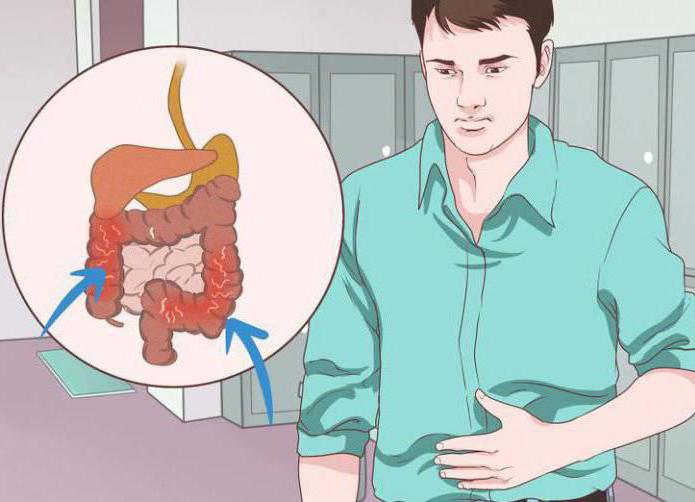 Analiza Roundworm Nacini Infekcije Ascaris