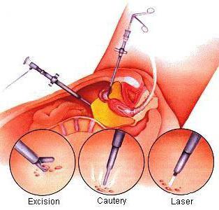 Порно жаттығу залына кірді Холли Мари Комбстың жалаңаш бейнесі